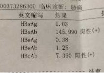 復聽在醫(yī)學上的意思是什么 醫(yī)生說的陽性和陰性有什么區(qū)別